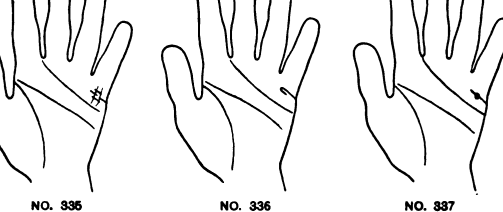 335