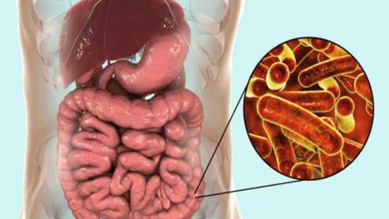 Stomach bacteria