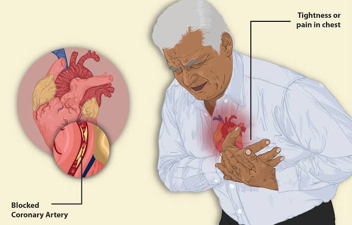 Natural Remedies and Diet for Heart Disease