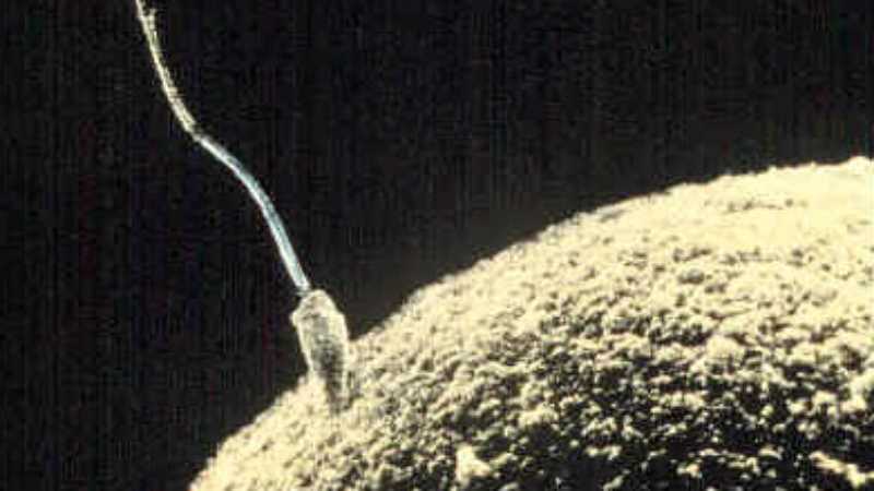 Sperm cell